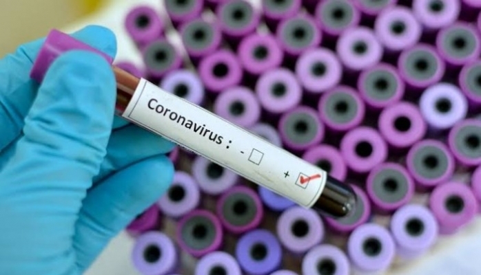 Dünyayı dehşete düşüren corona virüsü nedeniyle Avrupa’da ilk ölüm